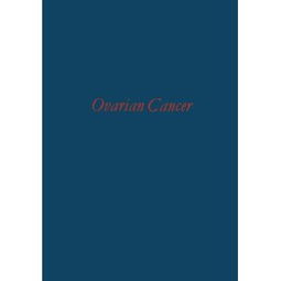 ovarian cancer cro,Ovarian Cancer: A Comprehensive Overview for You