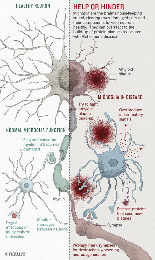 Understanding Brain Disease: A Comprehensive Overview for You