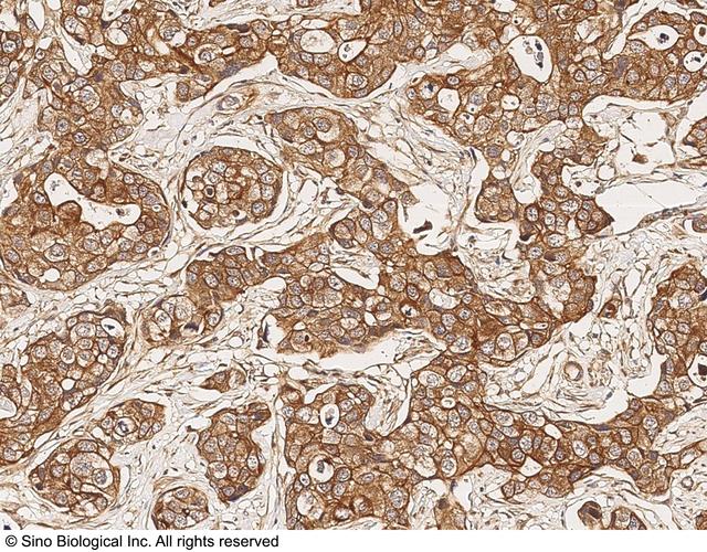 Understanding 3D Immunohistochemistry (IHC)